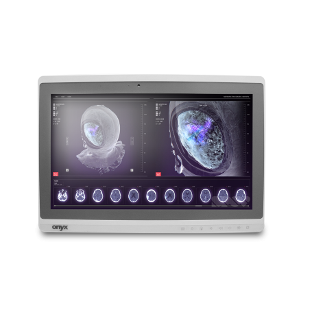ONYX PC AIO 2121DTT